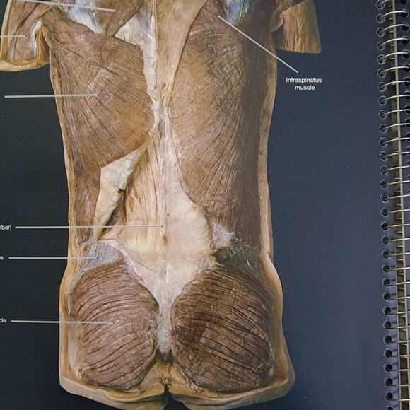 Martini's Atlas of the Human Anatomy Book for Medical Nursing Student 153 pages - Picture 4 of 8